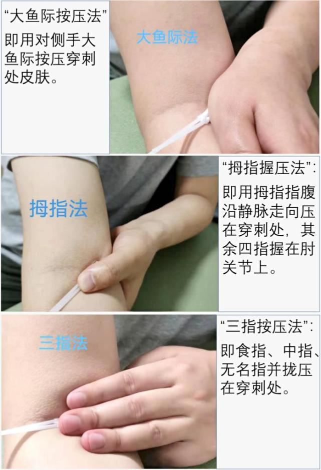 抽血后按压不当胳膊一片淤青?来学正确按压手法