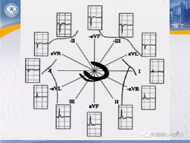 12導聯心電圖曾被稱為