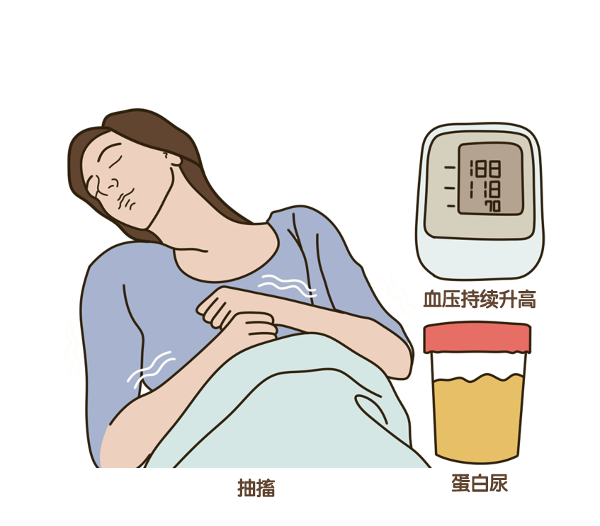 考虑到子痫可能导致胎盘早剥,早产,胎儿死亡,肺水肿,急性肾功能衰竭等