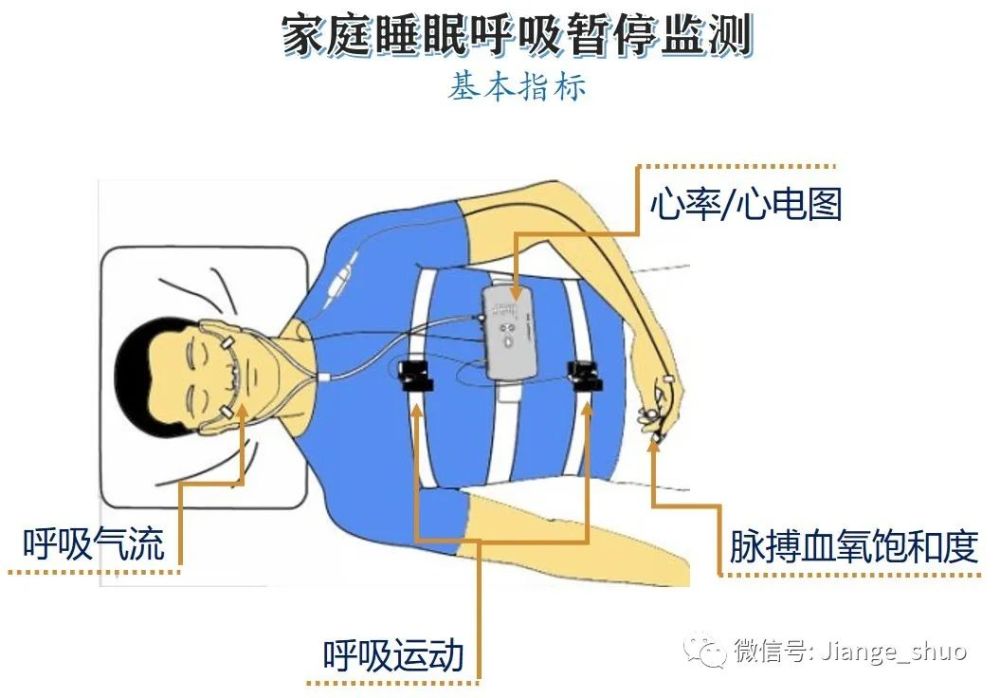 這個檢查需要患者在睡眠中心睡一夜,身上穿戴收集腦電波,心電圖,呼吸