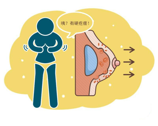 早期5个迹象,警惕乳腺癌!远离"粉红癌症",需要做好一件事