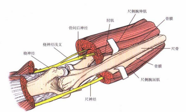 尺神经在尺侧腕屈肌深面,指深屈肌浅面下行,骨膜下剥离尺侧腕屈肌对尺