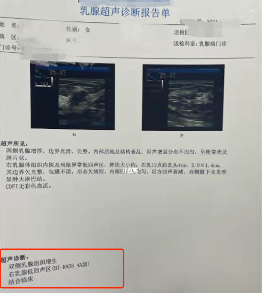 預防乳腺癌,從看懂乳腺超聲報告開始對於乳腺癌來說,做到知己知彼,方