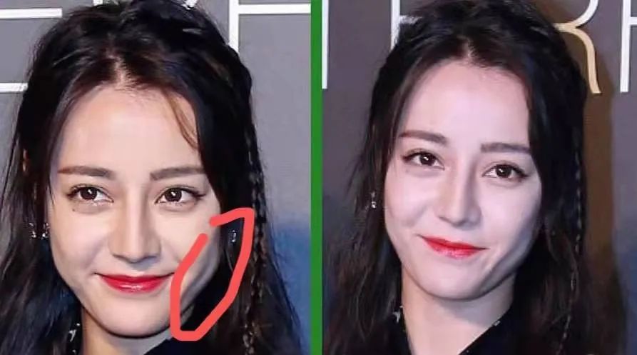 五官好看,"吃亏"在脸上,热巴脸颊凹陷,鞠婧祎颧骨突出_腾讯新闻