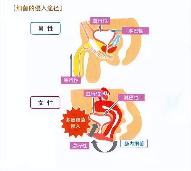 关于尿路感染,这些问题每一位女性都该知道!_腾讯新闻