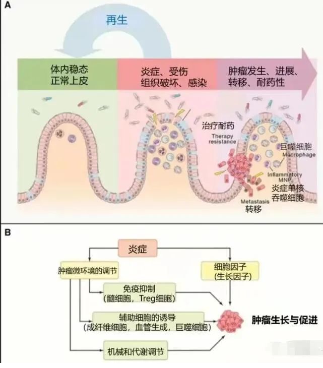 炎症丨疾病的罪魁祸首,干细胞有效减轻炎症反应