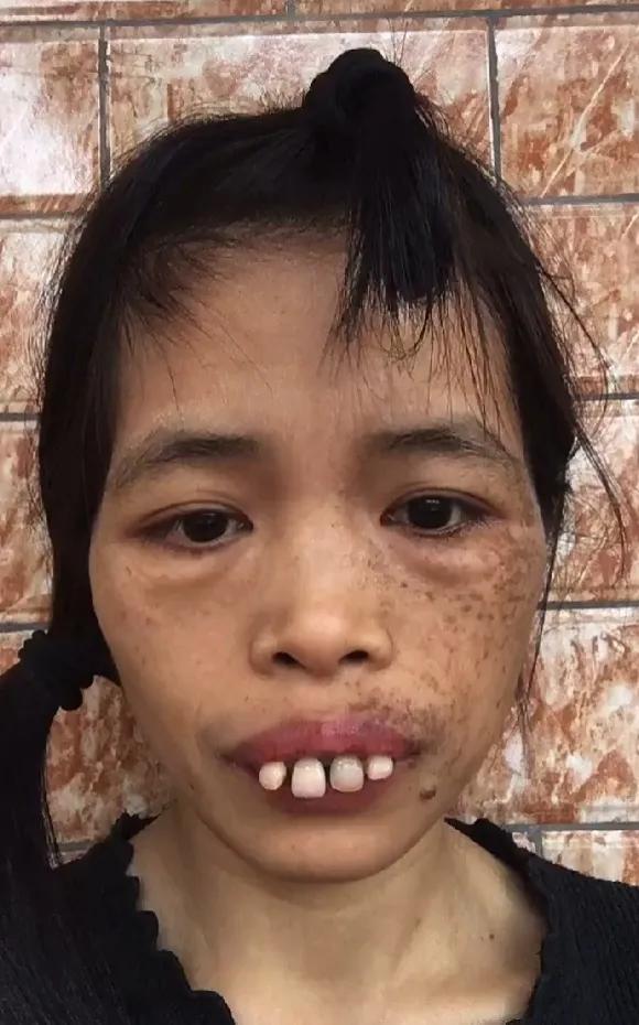 广西奇葩网红梅梅,靠奇丑长相一夜成名圈粉百万,她到底有何魅力