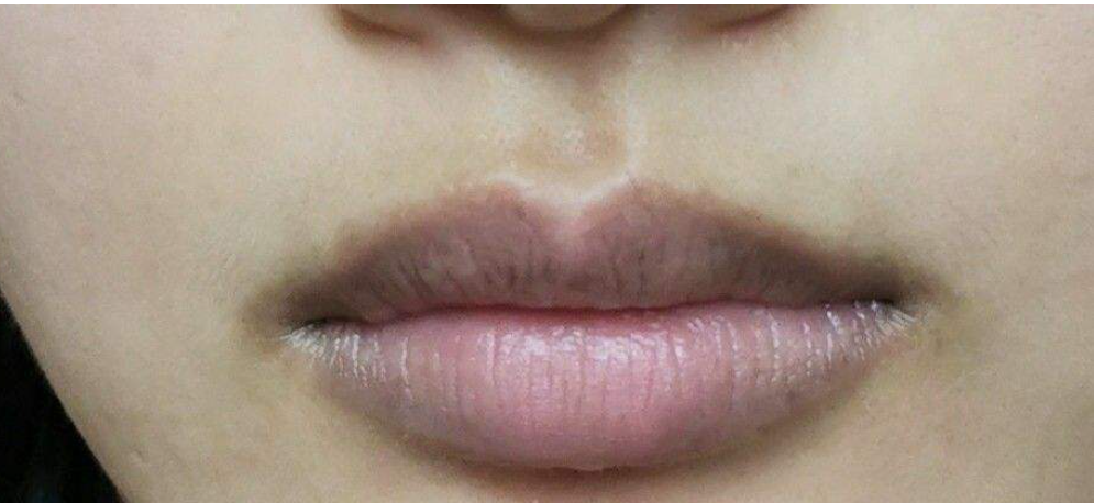 唇周暗沉,嘴角发黑,化妆都遮不住?这些改善的小技巧,你得知道插图