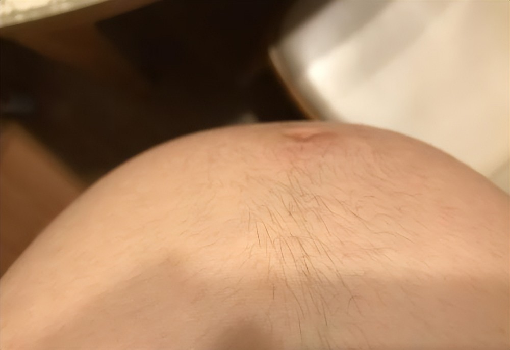 What is the problem of increased body hair in pregnant women after pregnancy?  Don't worry, it's a sign of your baby's healthy development - laitimes