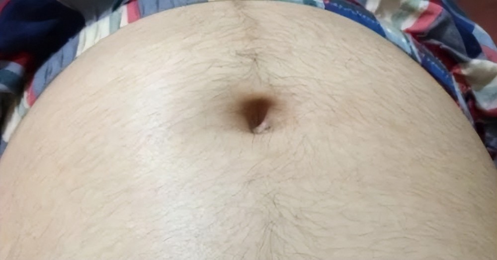 What is the problem of increased body hair in pregnant women after pregnancy?  Don't worry, it's a sign of your baby's healthy development - laitimes