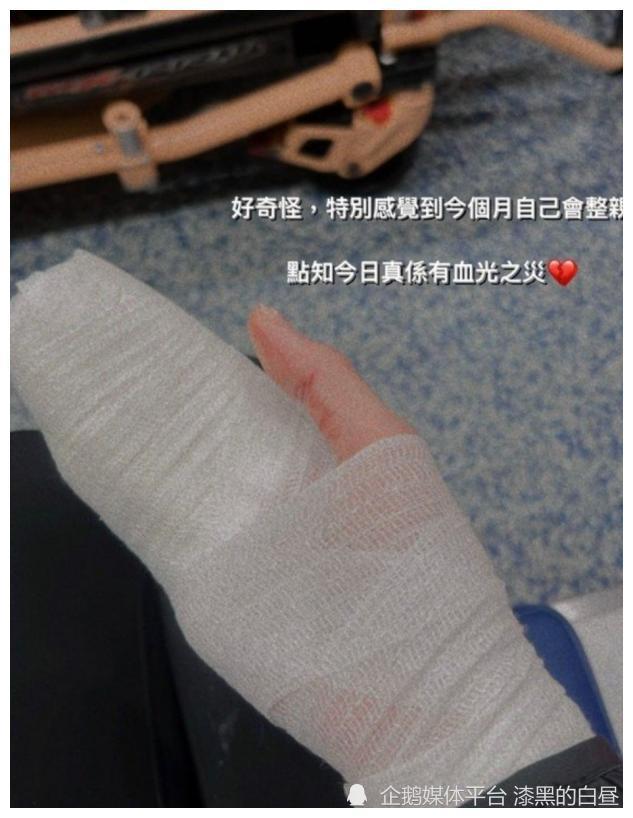 港姐遛狗遭惡犬咬傷,血流不止整隻手被紗布包裹,狗主人當場逃跑