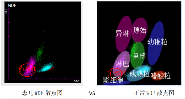 间隔不到36小时，为何两次血常规结果差别如此之大_腾讯新闻