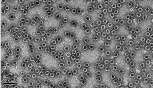 诺如病毒,过去称为诺瓦克病毒(norwalk viruses, nv),2002年国际病毒