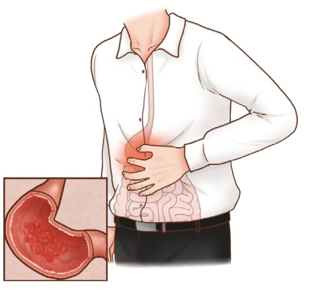 胆囊疼痛和胃疼位置图图片