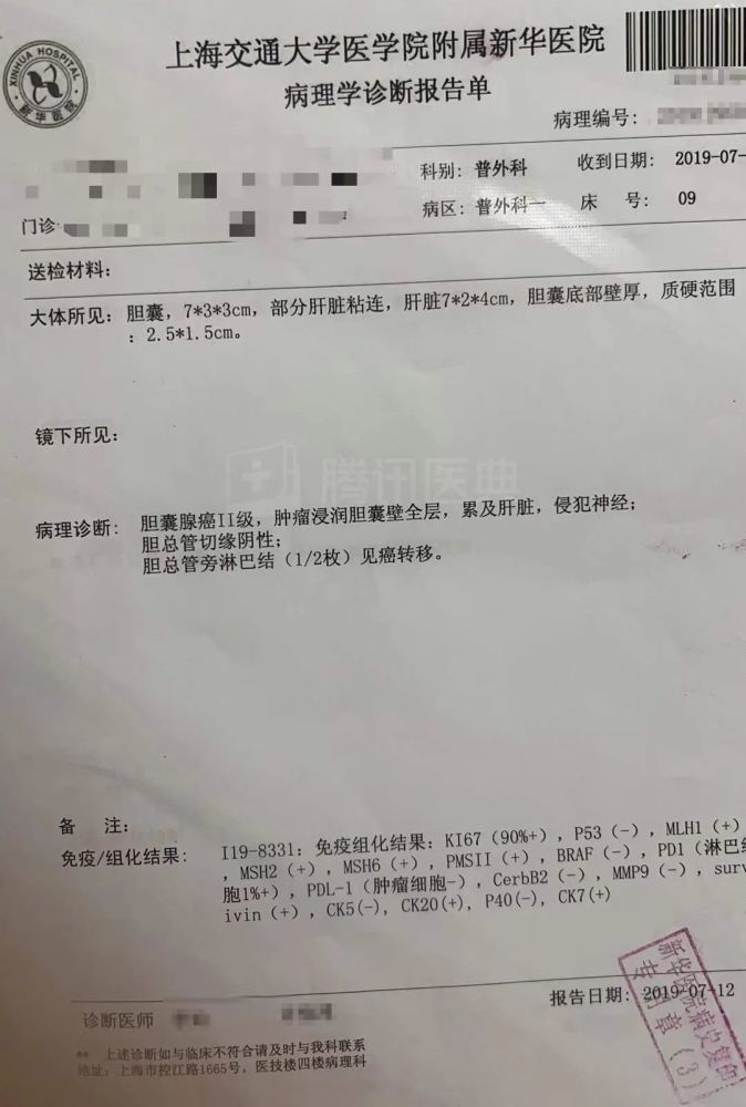 与胆囊癌抗争9个月后妈妈捐献了自己的眼角膜