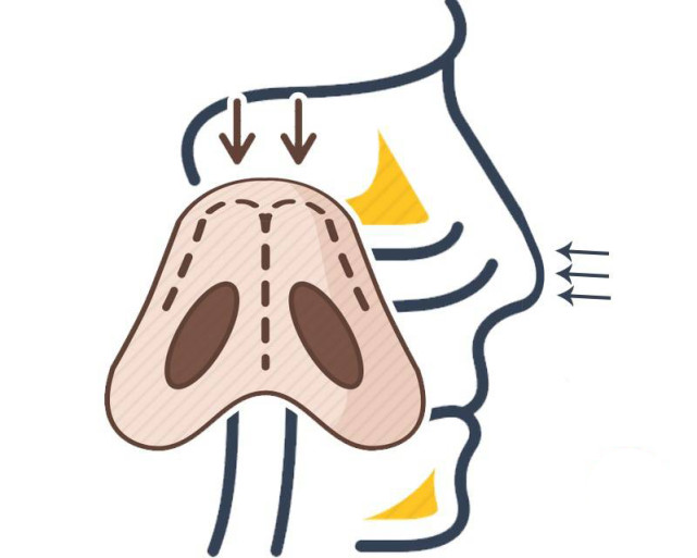 免疫系统会把它们干掉,但若赶上免疫力较差的时候,又或者将鼻腔抠破了