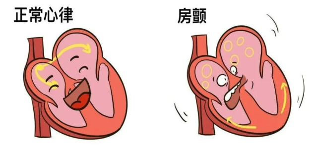 不僅會危及其他器官,甚至還會造成器官的衰竭,這種情況還會直接將人送