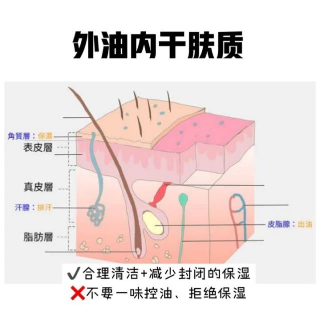 油性皮膚護膚攻略