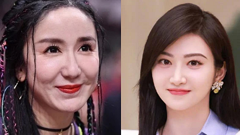 最严重的时候,娄艺潇笑起来脸上凹凸不平,苹果肌下垂严重,在嘴角两边