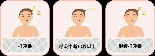 打呼噜不一定是睡得香谨防睡眠呼吸暂停综合征找上门