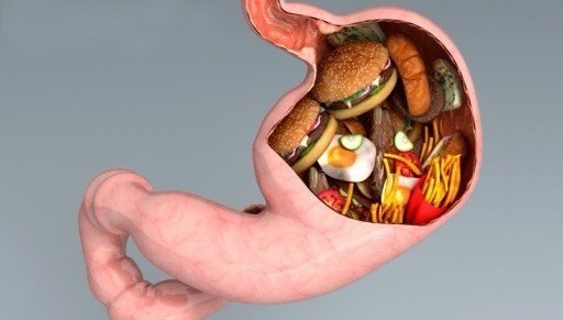 減肥手術(shù)切胃_減肥手術(shù)有哪些方法_手術(shù)減肥