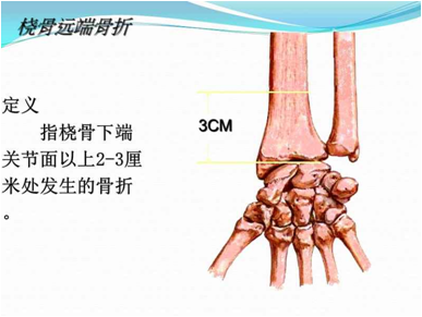 右侧桡骨远端正常图片图片