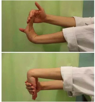 桡骨远端骨折究竟需不需要手术