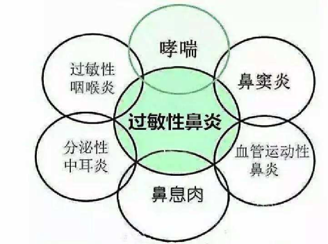过敏性鼻炎传染吗 腾讯网