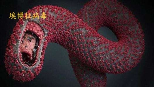 历史上致死人数最多的瘟疫-黑死病