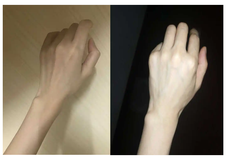 细手腕男生的痛如何让手腕变粗