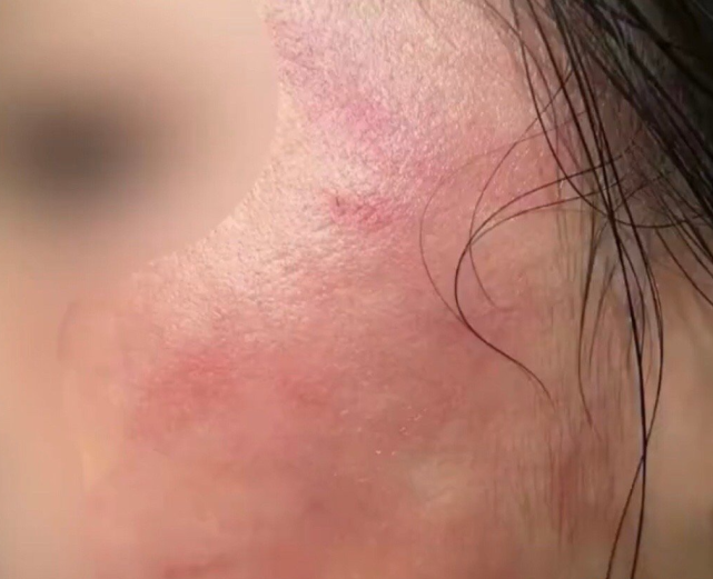 玉林一家长狂扇女孩到脸肿,只因