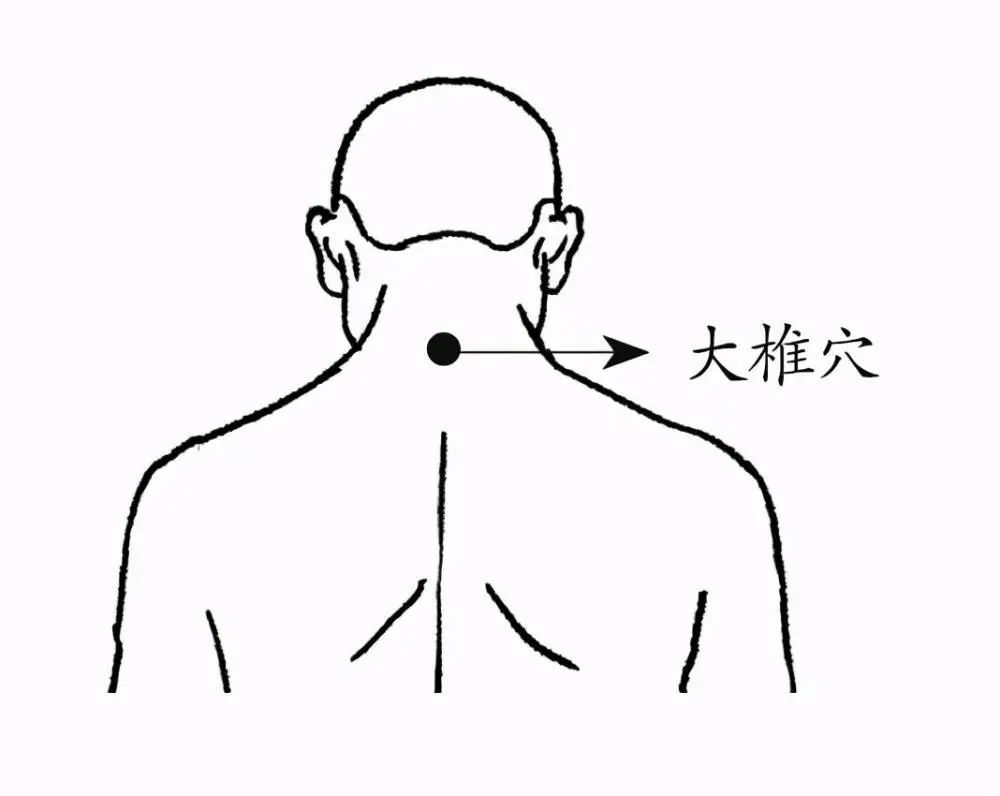 大椎穴振奋一身之阳气的万能穴