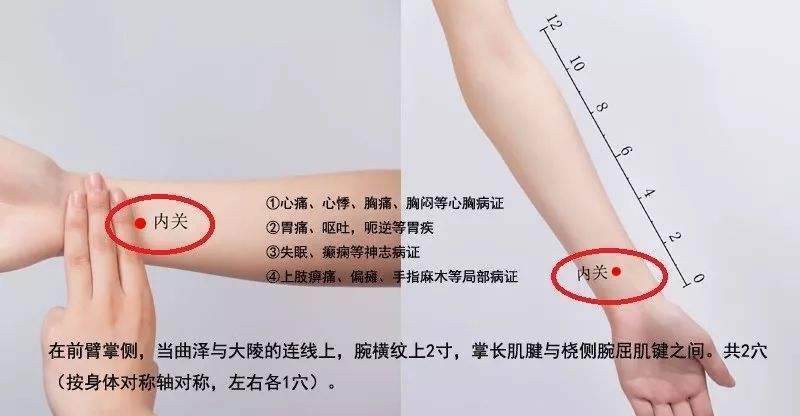 世界艾乡资讯-一针见效的针灸穴位之治疗心胸胃疾病第一要穴 内关穴