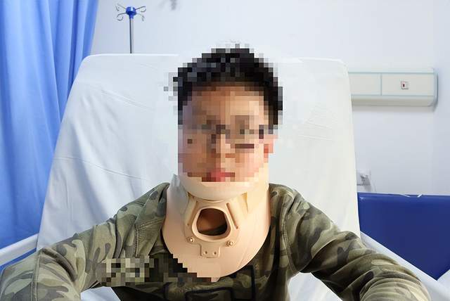 feil综合征)也称颈椎分节不良,是骨科罕见的先天性疾病,以短颈,低后