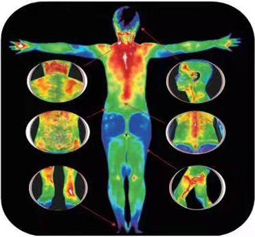 tmt医用红外热成像5分钟完成全身体检