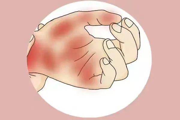 杭州32岁小伙去相亲,女孩父亲一看他的手:相亲缓缓,你赶紧去医院查查