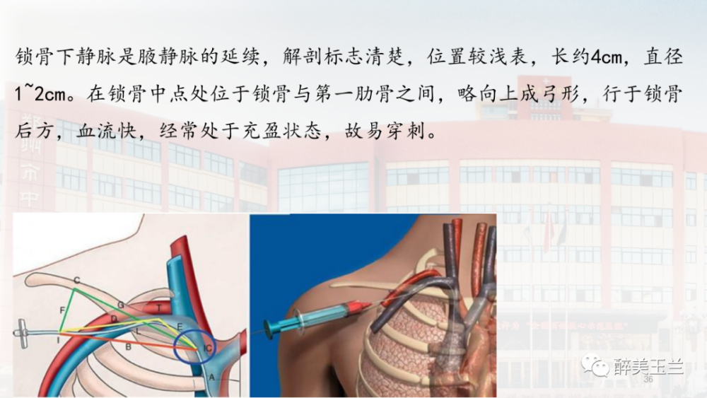 ppt中心静脉穿刺置管