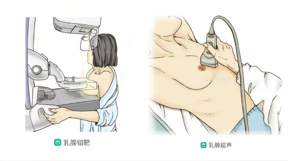 这项乳腺检查,是早期发现乳腺癌的有效手段_腾讯新闻