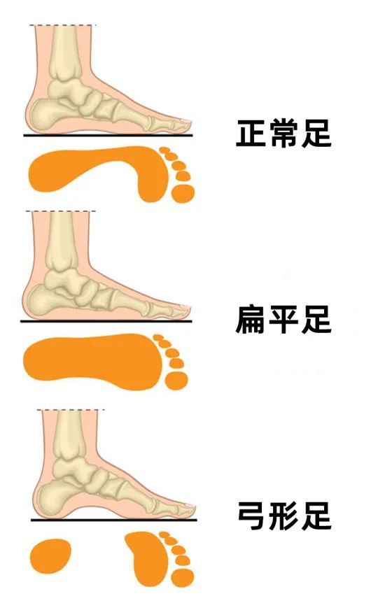 正常走路脚掌落地顺序图片