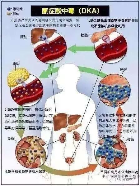 糖尿病的并发症原来这么多,快点来学习一下吧!