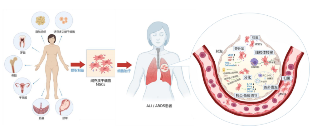 前沿间充质干细胞治疗急性肺损伤和性呼吸窘迫综合征的临床应用