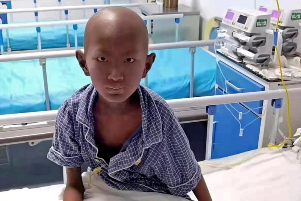 男孩患血癌做骨髓移植出仓时眉毛变白皮肤变黑妈妈我都认不出他了