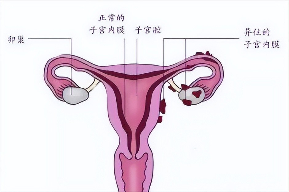 超級天后終懷孕卻在1個月後流產當初有多幸福現在就有多痛