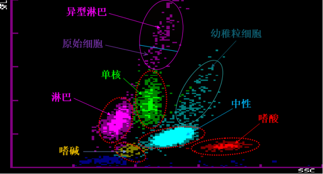 血常规异常白细胞散点图案例汇总_腾讯新闻