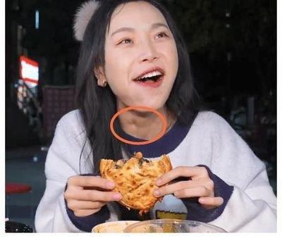 网红小贝再被扒出疑似催吐细节,网友:那又怎样