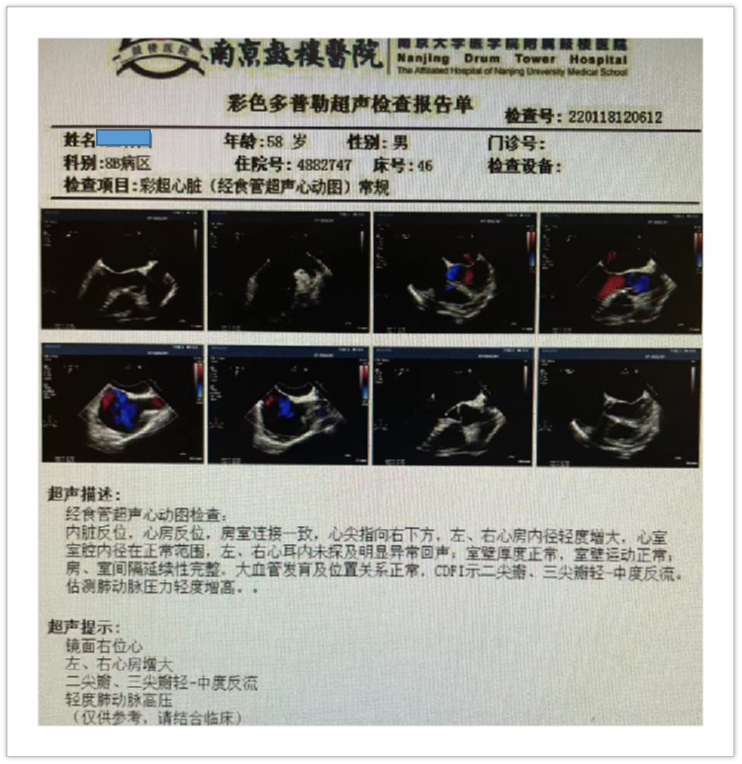 常规生化,传染病,甲功等,完善经食道超声检查三,检查计划持续性房颤的