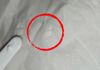 孙女士察觉有异常,于是拉过儿子检查,没想到竟然看到孩子体内有白色的