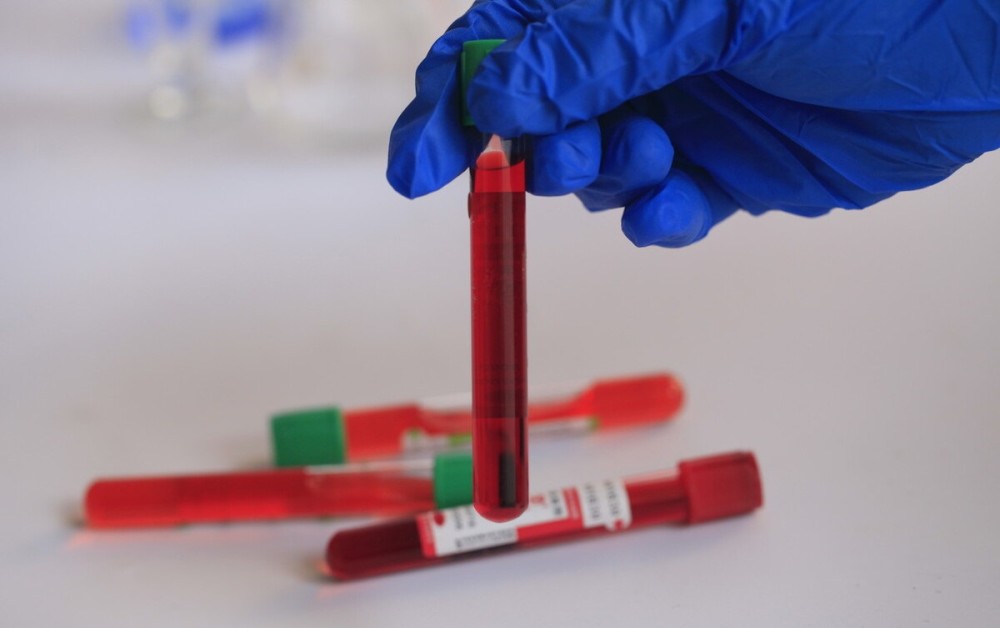 減肥藥物前十名_藥物減肥_減肥藥物有哪些