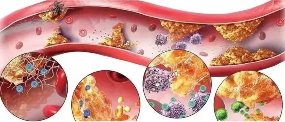当我们面对压力时,身体会进入一种"战斗或逃跑"的反应,这会导致炎症