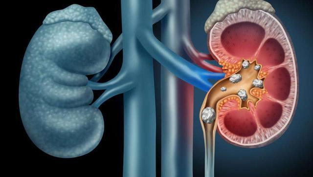 多半是是尿毒症的"求救信号",不要忽视掉_健康大河南